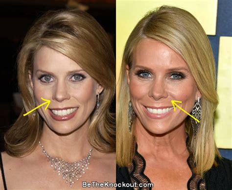 cheryl hines tits|Cheryl Hines Plastic Surgery Comparison Photos